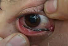 091708k5zpzosnp0fz309l.jpg